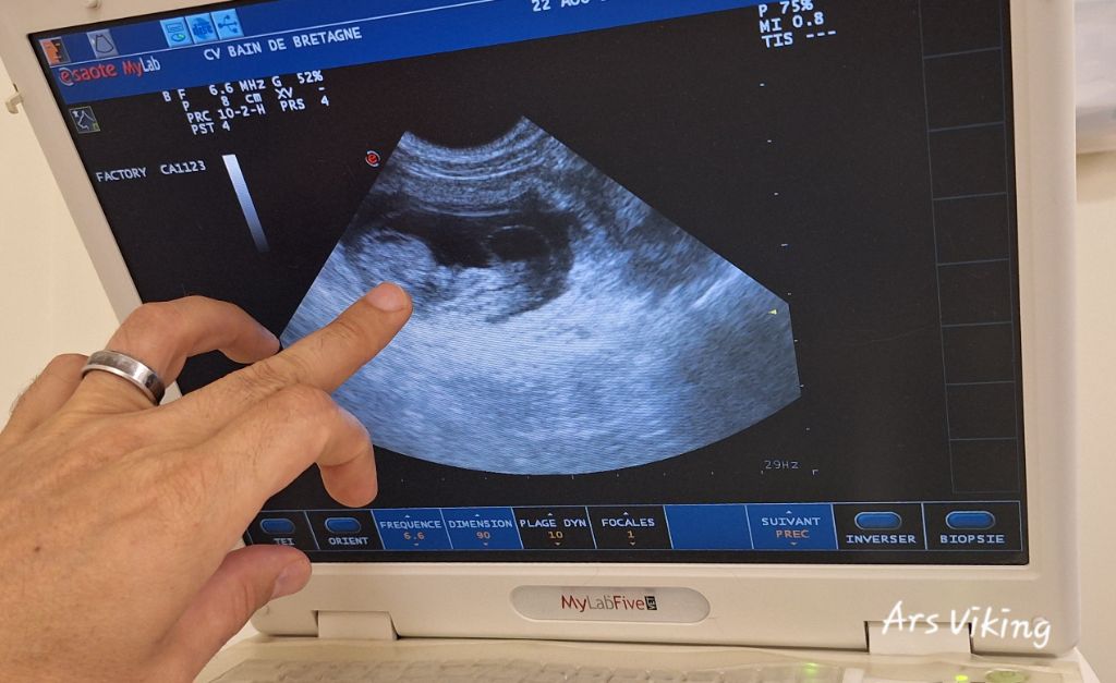 La gestation de Trinity est confirmé 